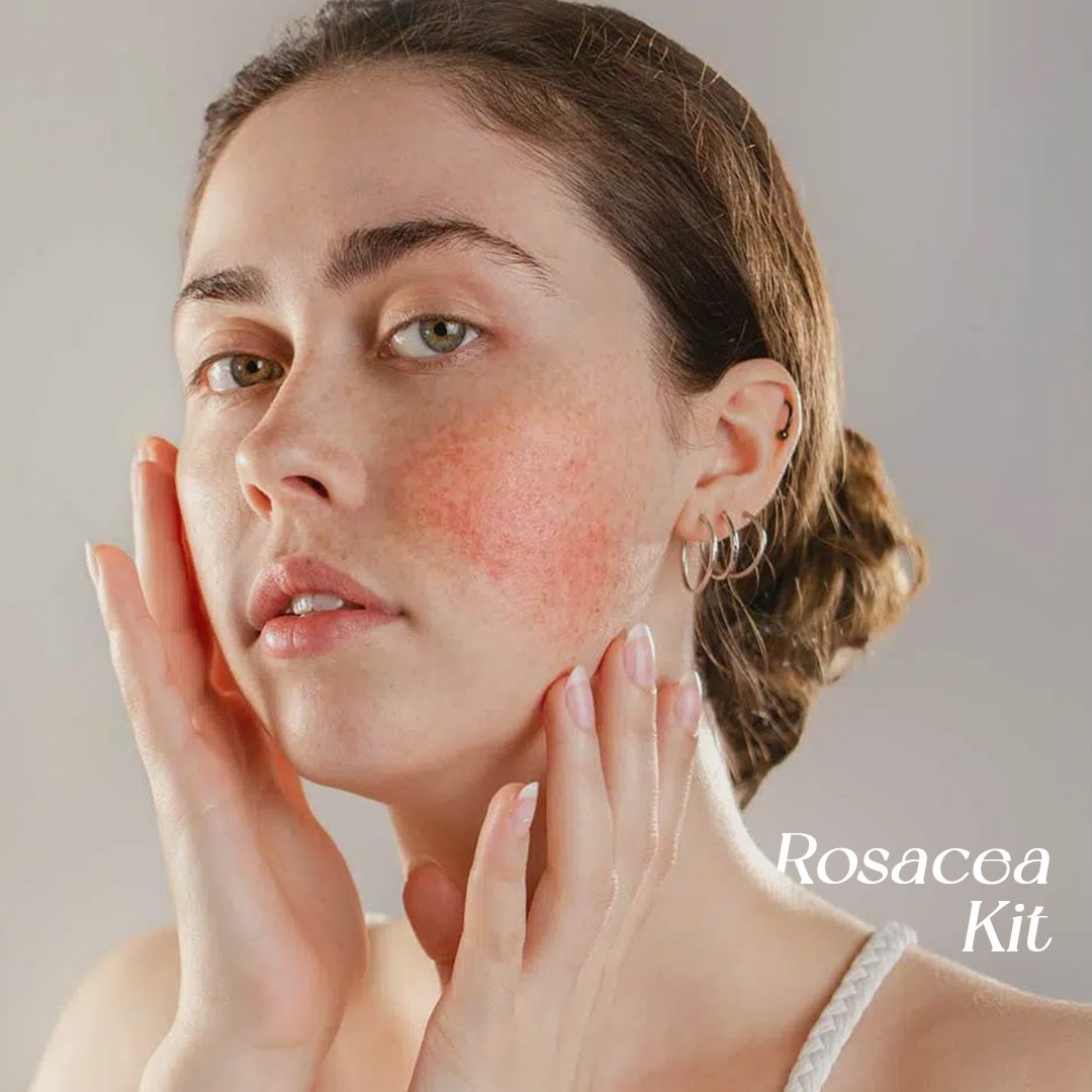 Skin Perfection Rosacea kit
